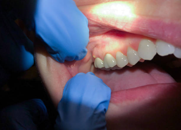 Best Urgent Dental Care in Parsons, KS