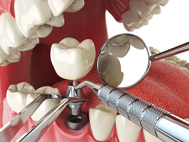 Best Emergency Dental Surgery in Parsons, KS