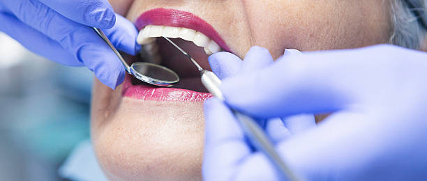 Best Emergency Root Canal Treatment in Parsons, KS