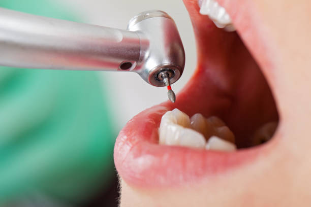 Best Emergency Tooth Extraction in Parsons, KS